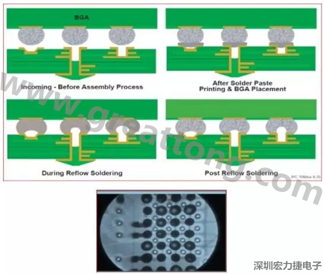 PCBA DFM問題實例6： BGA焊盤底下Via風(fēng)險